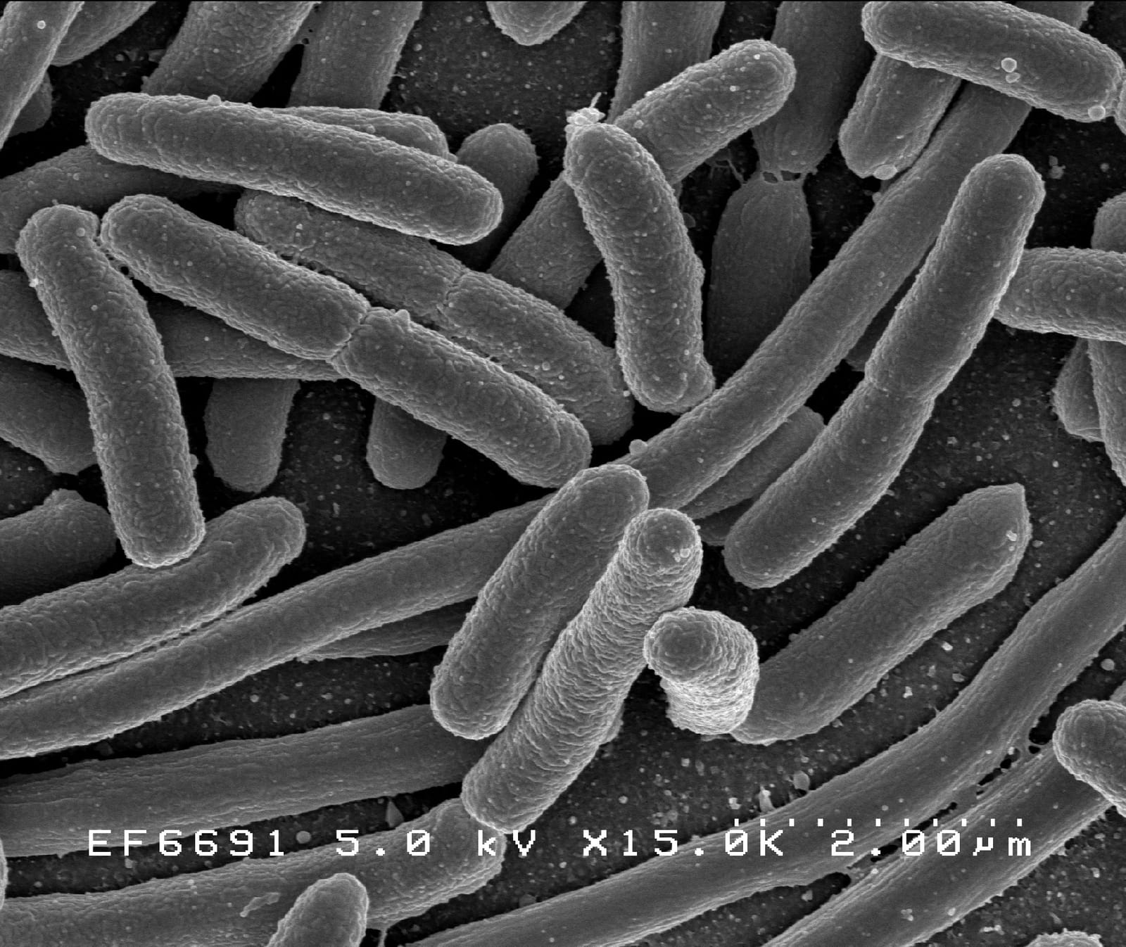 Micrographie électronique à balayage de bactéries Escherichia coli en forme de bâtonnets, très grossies